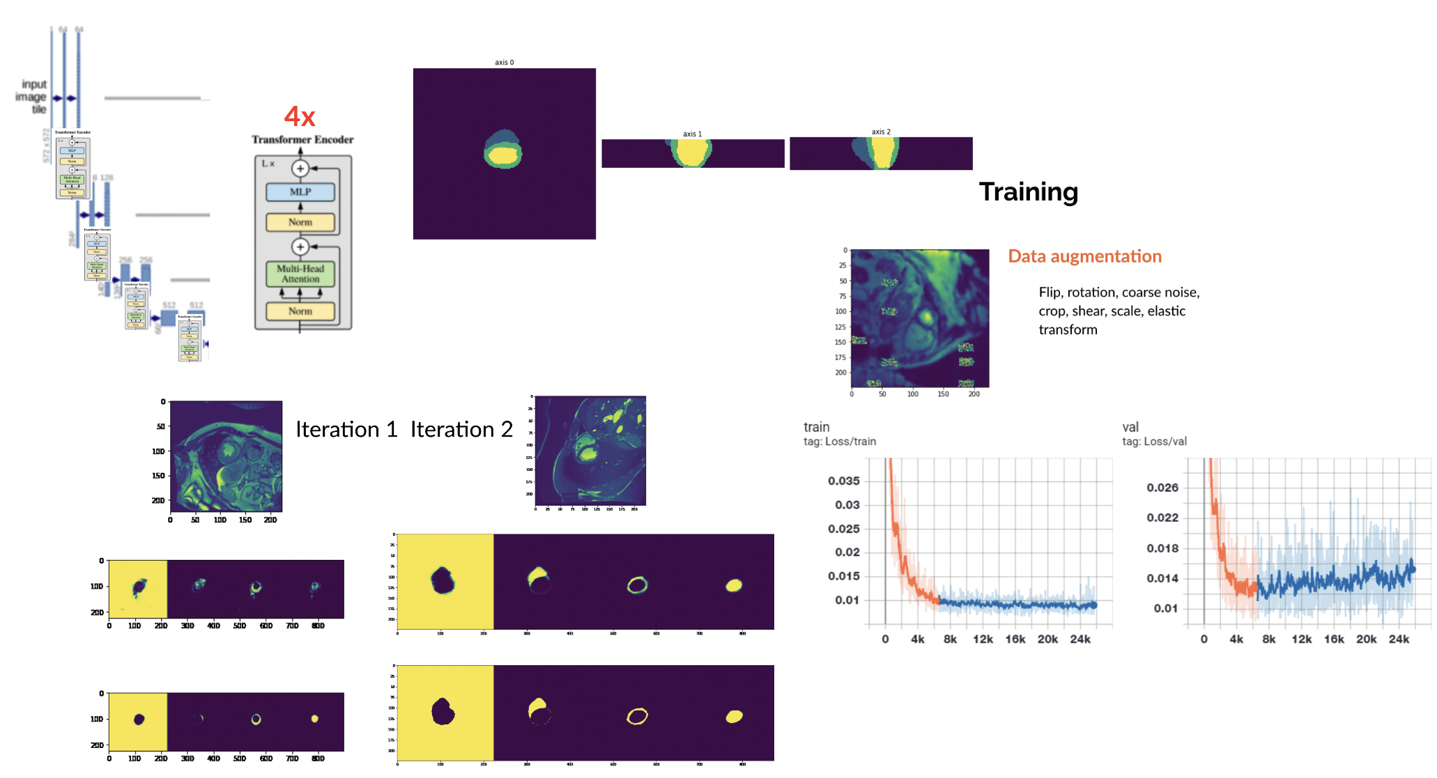 Medical Image Segmentation with U-Net